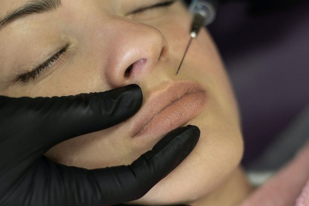 Botox injection being administered to a patient's forehead at a Cutler Bay clinic