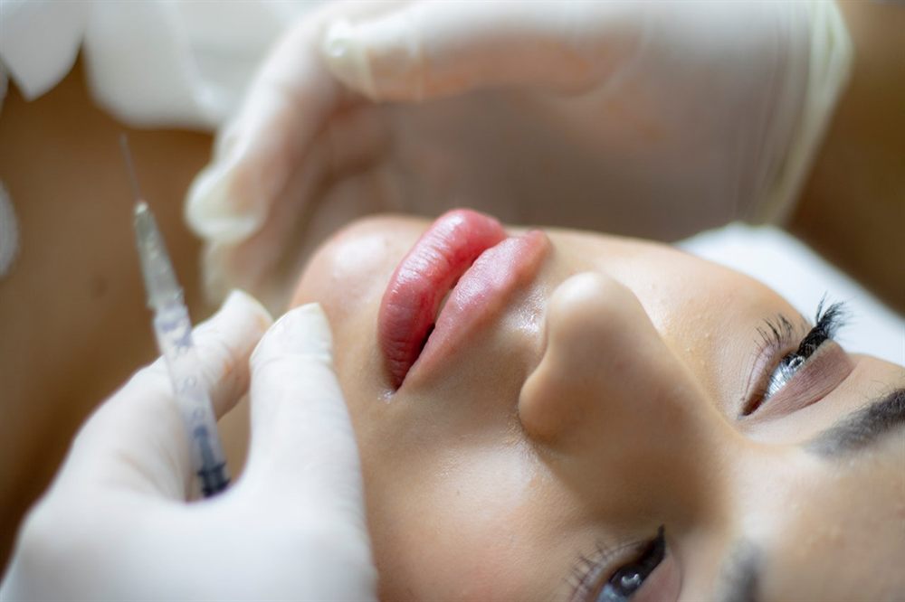 Aplicación de relleno dérmico en el pómulo de una paciente en una clínica estética de Cutler Bay